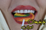 لمینت دندان در تهران